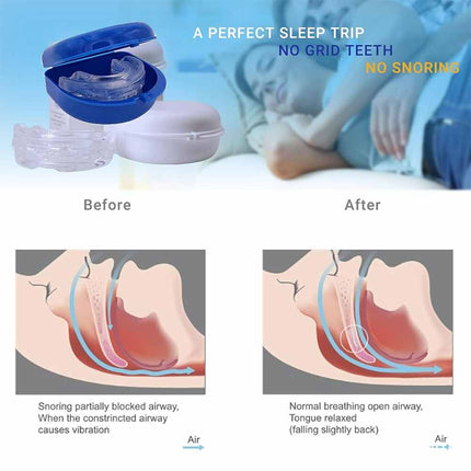 Anti snore device anti snoring solution mouthpiece