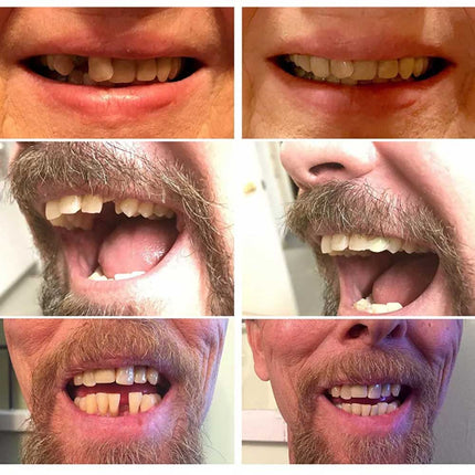 3X Instants Smile Comfort Fit Flex Teeth Top Temporary Teeth Replacement Repair