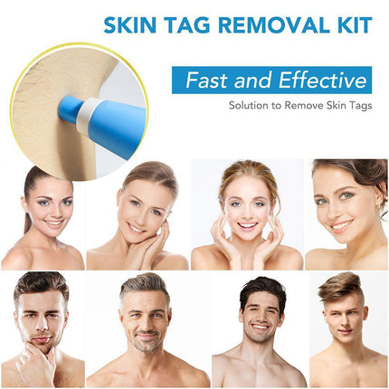 Auto Micro Skin Tag Remover Device Kit Safe Painless Removal 2-8 mm Band Tool