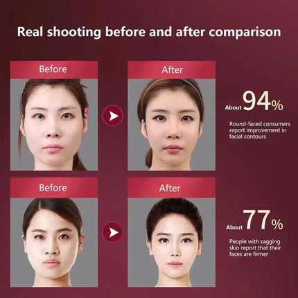 V-Face Shape Massager Skin Neck Lift Slim Double-Chin Removal LED Photon Therapy