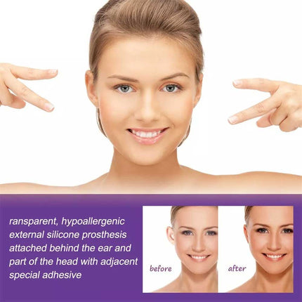 Earlap Cosmetic Ear Corrector, Earlap Prominent Ears Ear Corrector, 6pcs/box