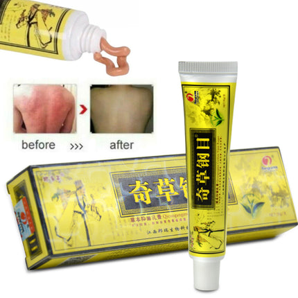 Natural Herbal Cream Allergy Itchy Treatment Ointment Skin Dry Relief