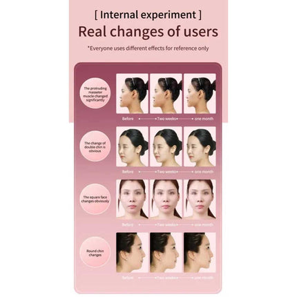 V-Face Shape Massager Skin Neck Lift Slim Double-Chin Removal LED Photon Therapy