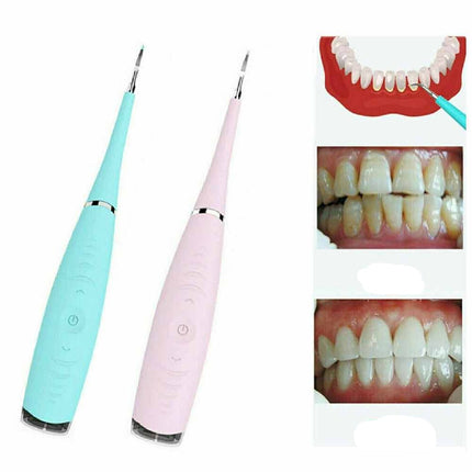 Electric Dental Scaler Tooth Stains Tool Tartar Calculus Plaque Remover Cleaner