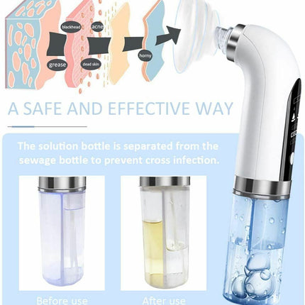 Vacuum Blackhead Remover Facial Skin Pore Acne Pimple Suction Cleaner Machine