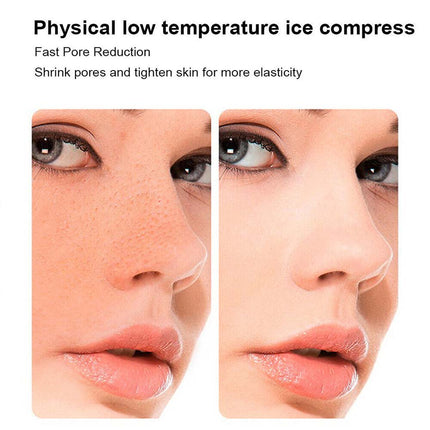 Ice Facial Cube Massager Ice Rollers to Depuff Lifting Contour Roller Face Care