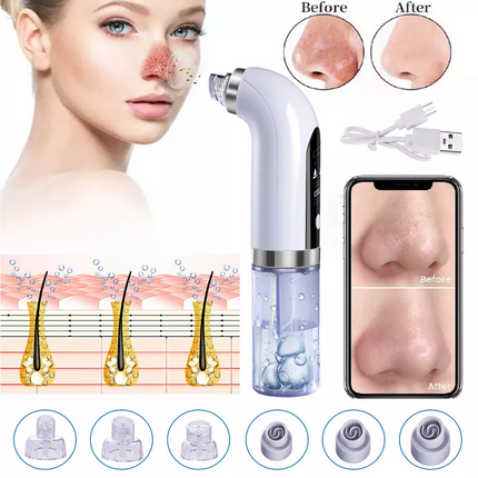 Vacuum Blackhead Remover Facial Skin Pore Acne Pimple Suction Cleaner Machine