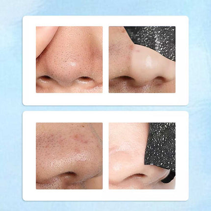 50PCS Nose Pore Strips Blackhead Removal Unclog Pores Deep Cleansing Head
