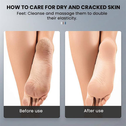 Professional Electric Foot Grinder File Callus Dead Skin Remover Pedicure Tool Free Tips