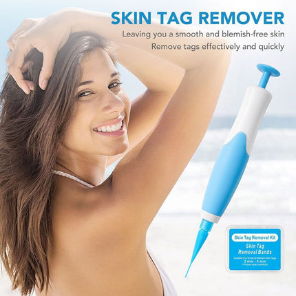 Auto Micro Skin Tag Remover Device Kit Safe Painless Removal 2-8 mm Band Tool