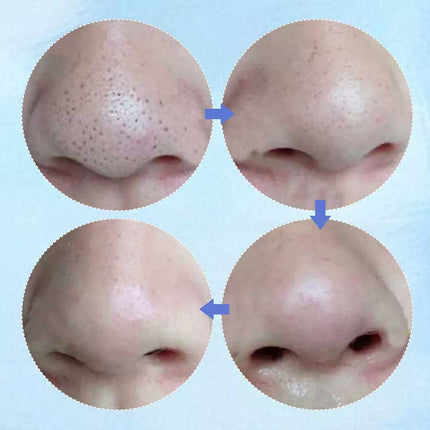 50PCS Nose Pore Strips Blackhead Removal Unclog Pores Deep Cleansing Head