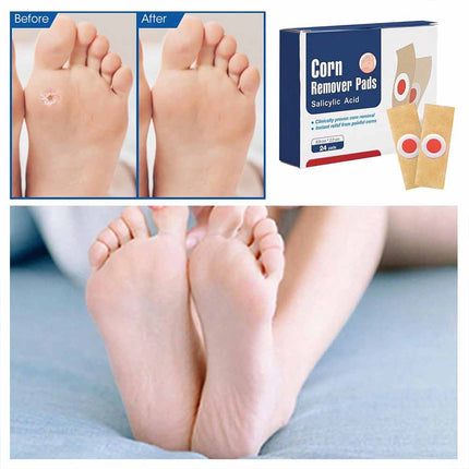 Corn Pads for Toes 24pcs Gentle Callus Removal Toes and Feet Adhesive