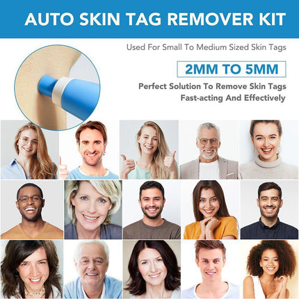 Auto Micro Skin Tag Remover Device Kit Safe Painless Removal 2-8 mm Band Tool