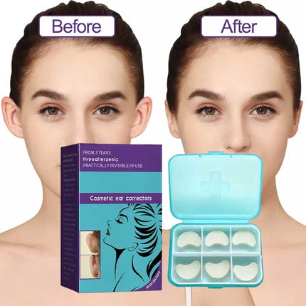 Earlap Cosmetic Ear Corrector, Earlap Prominent Ears Ear Corrector, 6pcs/box