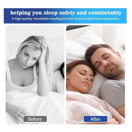 4Pc Sleeping Mouth Guard for Clenching Teeth, Stops Bruxism, Reusable with case